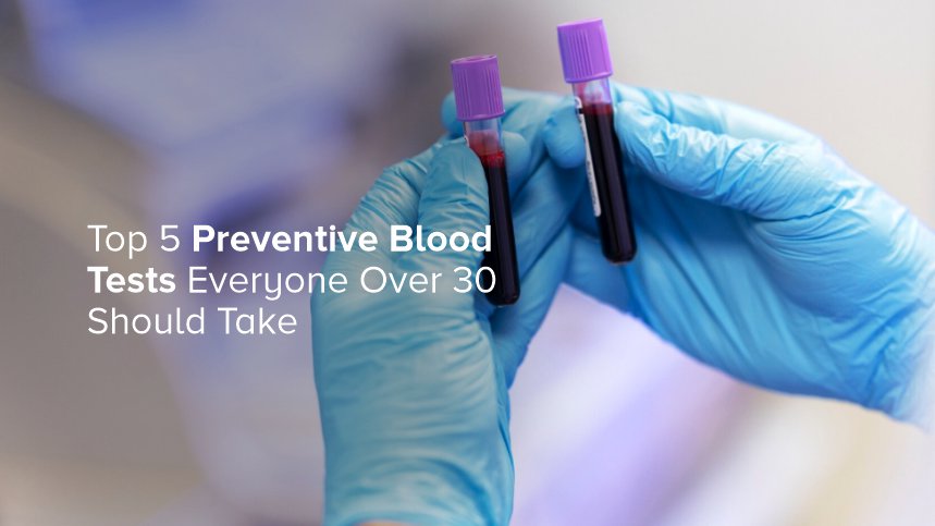 Top 5 Preventive Blood Tests Everyone Over 30 Should Take